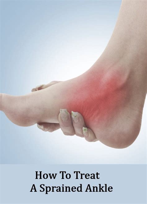 Swollen ankles and swollen feet are common and usually not cause for concern, particularly if you have been standing or walking a lot. How To Treat A Sprained Ankle | Sprained ankle, Treating a ...