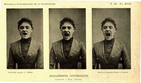 Female hysteria was once a common medical diagnosis for women, which was described as exhibiting a wide array of symptoms, including anxiety, shortness of breath, fainting, nervousness, sexual desire, insomnia, fluid retention, heaviness in the abdomen, irritability, loss of appetite for food or sex, (paradoxically) sexually forward behaviour, and a tendency to cause trouble for others. baillement-nle-icono-salpetriere