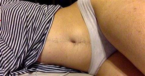 However, growing hair on the belly during pregnancy. We can't figure out why Twitter is freaking out over this ...