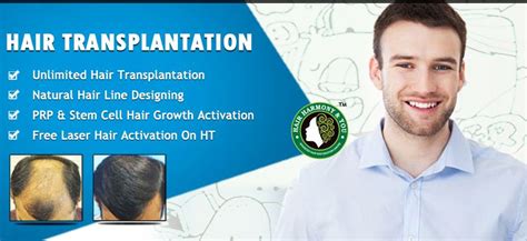 Mind the hair restoration procedure. Get Hair Transplant At Discount Rates For Limited Period ...