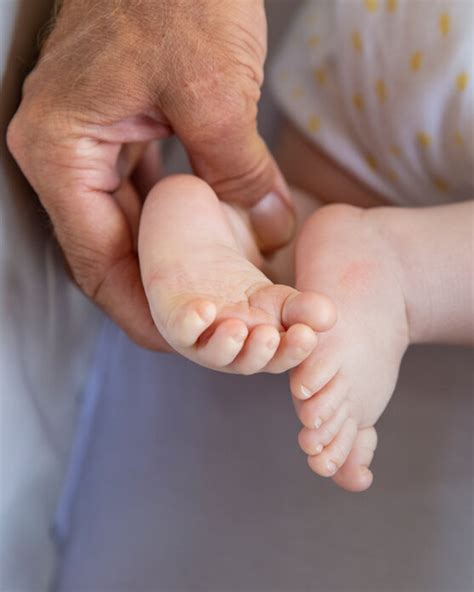 Sie kann angeboren oder erworben sein und ist oft mit anderen fußfehlbildungen kombiniert. Sichelfuß beim Baby: Behandlung der Fehlstellung mit Orthesen