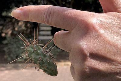 To use duct tape to remove cactus needles from your skin, stretch a piece of duct tape over the affected if it's an area that's prone to getting dirty, such as your hands and feet, a bandage might help keep the wound clean. Cholla (Cylindropuntia) Cactus: Treacherous but Beautiful.