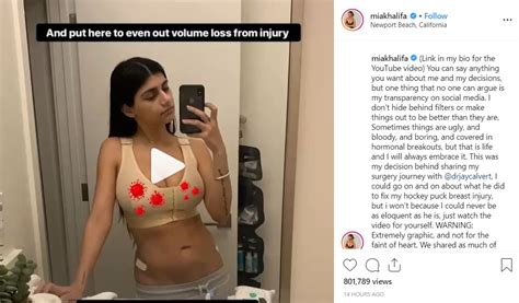 Explore mia khalifa profile at times of india for photos, videos and latest news of mia khalifa. Mia Khalifa Shares Video From Breast Surgery Following ...