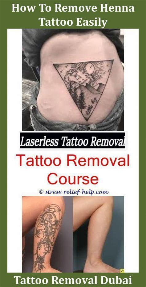 Alternatively, you can pour a small amount of rubbing alcohol onto a. Where Can You Get A Tattoo Removed,laser tattoo removal ...