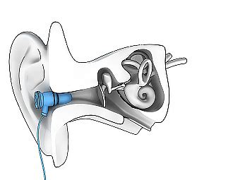 You are able to easily step up the. What's that? How earbuds can wreck your hearing ...