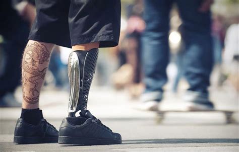 If you have a lower limb amputation, or you will. CUSTOM PROSTHETIC LEGS | Prosthetic leg, Prosthetics, Leg ...