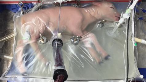 During pregnancy, the uterus holds the developing baby. 'Plastic bag' womb could help keep premature babies alive ...