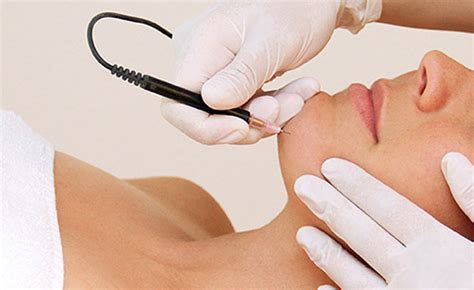 The cost depends on the number of sessions you need. Permanent Hair Removal Guide - Harmony Beauty Therapy