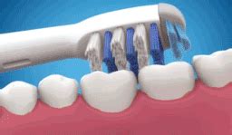 ¿cepillo de dientes rotativo ya sónico? Cepillos eléctricos sónicos Vs rotativos: ¿Cuál es mejor?