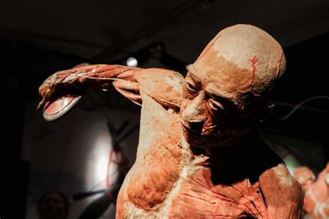'Real Bodies', uno dei cadaveri finisce in sala operatoria ...