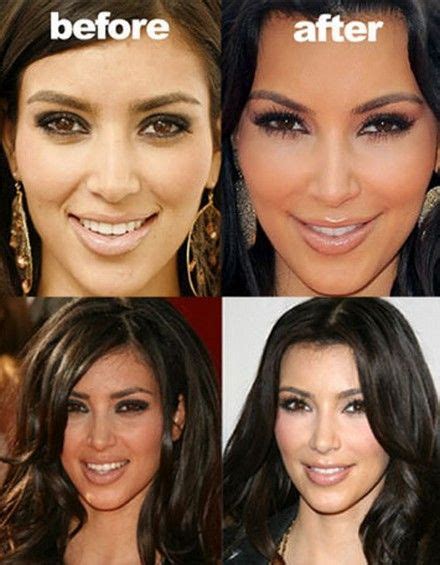 Kim Kardashian Face Before and After Plastic Surgery. I ...