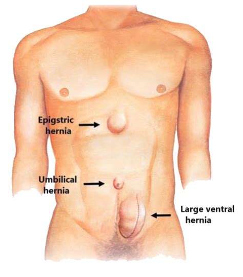 colorectal cancer is the 2nd leading cancer killer in the united states. Gastrointestional & General Surgery | Asian bariatrics ...