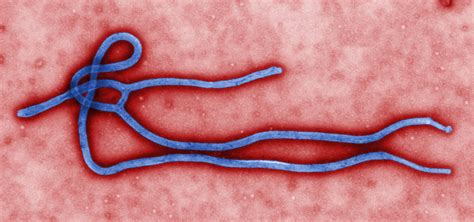 Ebola adalah penyakit akibat infeksi virus mematikan, yang bisa menyebabkan demam, diare, serta perdarahan di dalam tubuh penderitanya. Klasifikasi Virus - Info Pendidikan dan Biologi