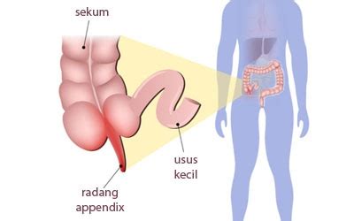 We did not find results for: Gajala Radang Usus Buntu Kronis | Uraian Sehat