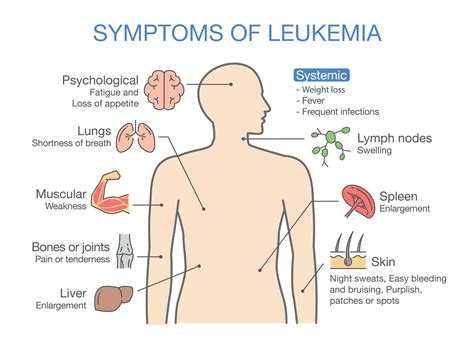 Common leukemia symptoms may include fevers or night sweats, frequent infections, feeling weak or tired, and headaches. What are the symptoms of leukemia? - DoctorxDentist