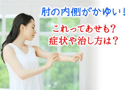 肘の内側がかゆい!これってあせも？症状や治し方は？