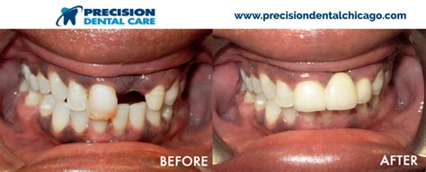 We are committed to promoting lifelong dental health. Precision Dental Care | The Best Dentists in Chicago IL