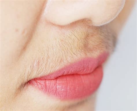 Best upper hair lip removal cream. Five Easy Remedies To Remove Upper Lip Hair