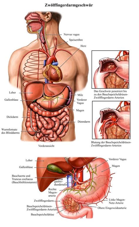 Gastritis is mostly a histological term that needs biopsy to be confirmed. Gastritis, Magenschleimhautentzündung, Behandlung ...