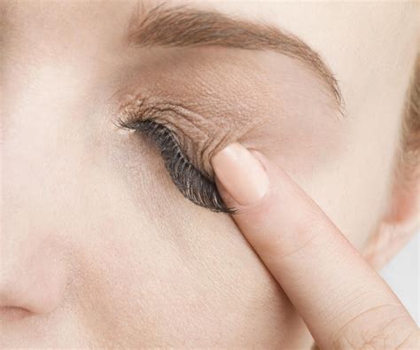 2,179 likes · 1 talking about this. Common Causes of Eyelid Rashes