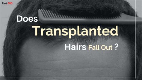 Hair usually starts to shed at 8 to 12 weeks of age, and begins to grow back at around 3 to. Does transplanted hair fall out after surgery | HairMD ...