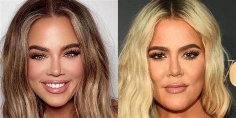 Khloé Kardashian Before : Khloe Kardashian S Ever Changing Face As She 