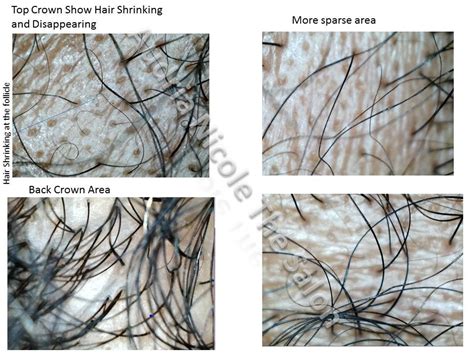 Check spelling or type a new query. We offer microscopic digital analysis of the scalp to help ...