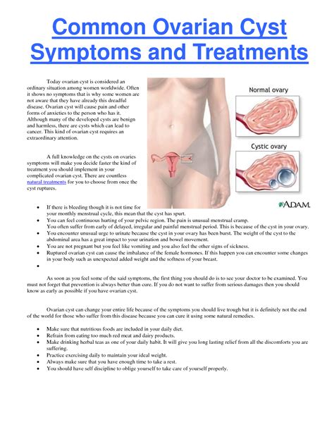 The ovarian cancer symptoms consensus statement below was adopted in 2007 based on current research and was endorsed by many organizations. Common Ovarian Cyst Symptoms and Treatments by dexterfly # ...