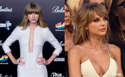 Maybe you would like to learn more about one of these? Taylor Swift Plastic Surgery Before and After Photos ...