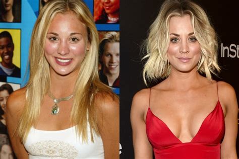 Inoltre, un altro aspetto importantissimo relativo alla scelta del chirurgo estetico riguarda il centro o la clinica. Kaley Cuoco rivela: Ho rifatto il seno e il naso, ecco la ...