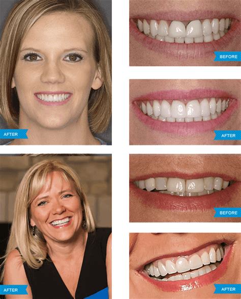 We would like to show you a description here but the site won't allow us. Dentist Greensboro NC - High-Quality Dental | Steven L ...