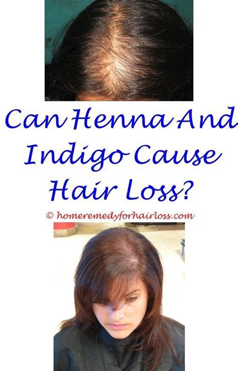 Symptoms and causes, effective treatment. how many chemo treatments until hair loss - hcg diet ...