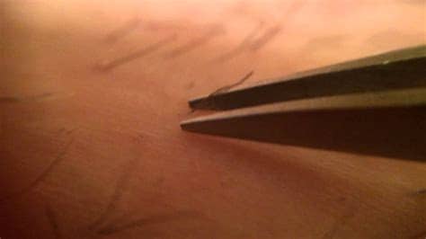 Underarm hair, as human body hair, usually starts to appear at the beginning of puberty. Trich Pluck & Pull hair with tweezers MACRO video w ...