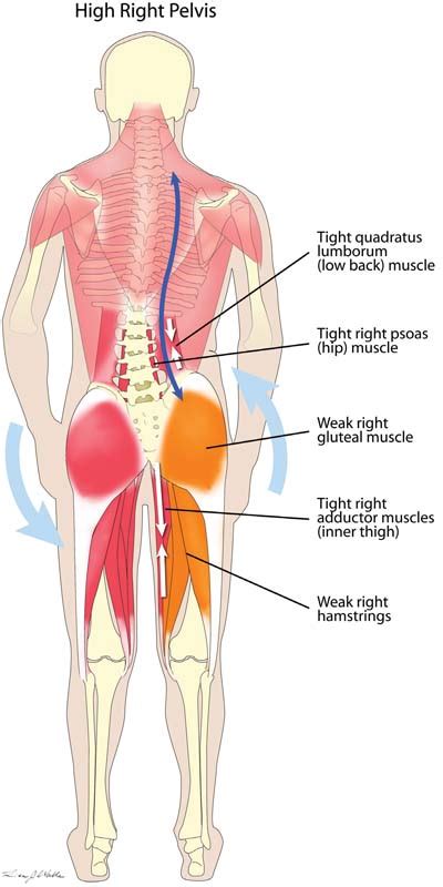 There are anterior muscles diagrams and posterior muscles diagrams. Low back pain treatments | Manchester Osteopathy