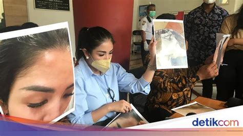 Nindy ayunda diketahui telah dua kali mendatangi kepolisian. Hadir di Sidang Cerai Nindy, Ibunda Ungkap Lebam di Tubuh ...