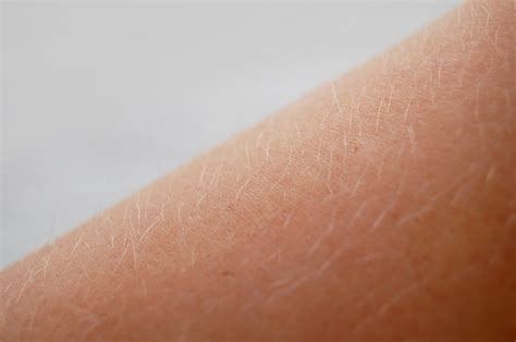 People with red, very blonde, and white hair won't see results from laser hair removal and shouldn't. Does Laser Hair Removal Work On Blonde Hair? — SkinFX Canada