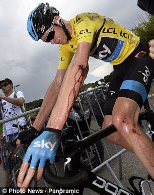 Har blitt en centimeter kortere etter skrekkvelt. Chris Froome battered and bruised after crash in Criterium ...