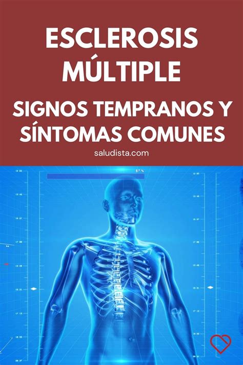 Toda la información sobre síntomas, causas, tratamientos, diagnósticos. Esclerosis múltiple: Signos tempranos y síntomas comunes