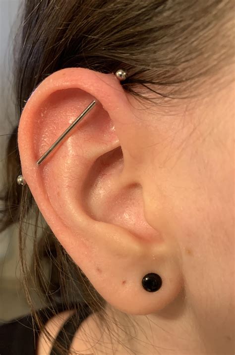 My industrial piercing is developing a bump. Please see details in ...