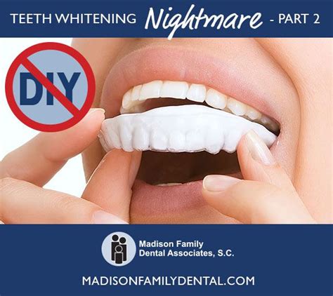 Diy teeth whitening for any budget. Pin on Dental Health Resources