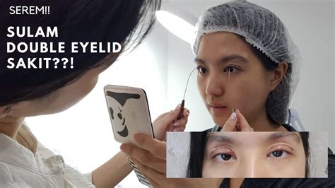 Maybe you would like to learn more about one of these? SEREM!! Sulam Eyelid (Lipetan Mata) Sakit??! - YouTube