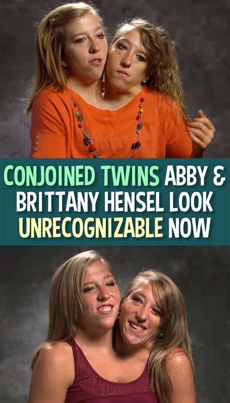 Clip from abby and brittany college and beyond, 2012. Conjoined Twins Abby & Brittany Hensel Look Unrecognizable ...