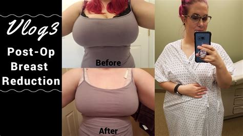 Dès leur première commande passée sur le site, ces derniers profiteront d'une réduction de 7€ à valoir sur un minimum. VLOG 3 | Breast Reduction Day 1-5 - YouTube