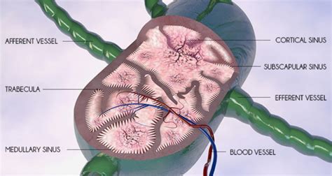 You might have any of the following symptoms if your cancer has spread to the lymph nodes: Lymphedema Awareness Day: Is Lymph node removal with ...