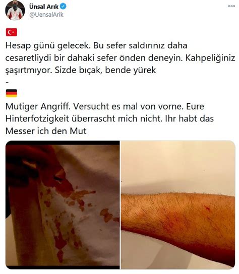 Ünsal arik ist im bayrischen parsberg geboren und aufgewachsen. AKP'lilerin hedefindeki Ünsal Arık'a bıçaklı saldırı ...