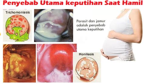 Keluar lendir kental bercampur darah dari vagina. obat keputihan bagi ibu hamil | Obat Ambeien