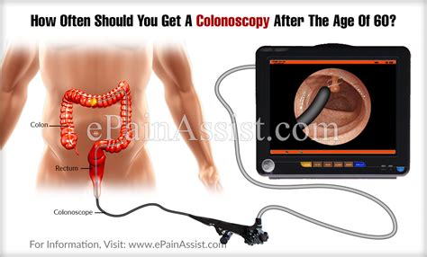 It also allows you to get a foot into your university of choice. How Often Should You Get A Colonoscopy After The Age Of 60?