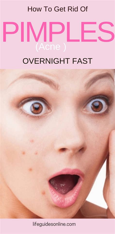 Here, learn about the different types that can form in this area, why they occur, and how to prevent and treat them. How To Get Rid of acne overnight fast. Home remedy to get ...