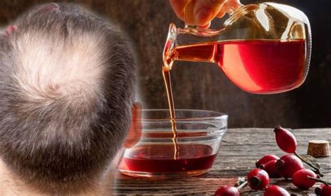 Working out makes the pores in your scalp open up and increases blood flow to your scalp and massaging your brushing hair is a daily activity part of everybody's life. Hair loss treatment: Traditional plant for a healthier ...