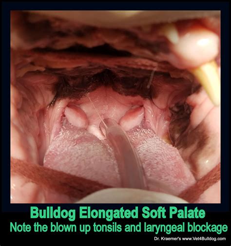 Although ideal candidates are at least 18 to 21 years old, many parents wonder if it would be similarly effective on their children. Does My Bulldog Need Soft Palate Surgery and How would I know